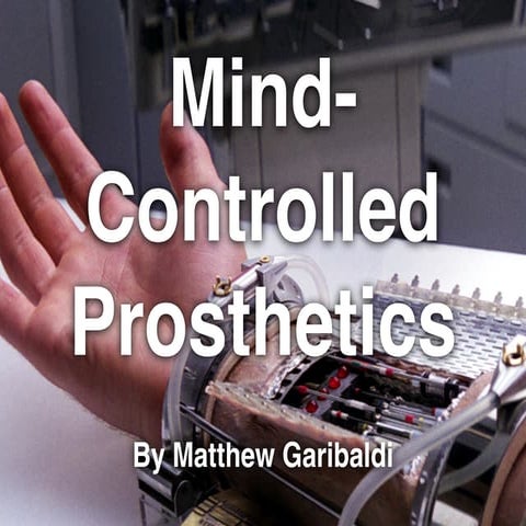 Mind-Controlled Prosthetics, by Matthew Garibaldi