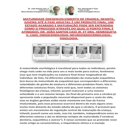 Maturação Esquelética: Criança,Infantil,Juvenil,Processo Morfológico para Tod...