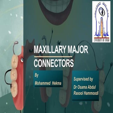 Maxillary major connectors by mohammed hekma