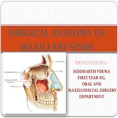 maxillarysinuspresentation-201208183440.pptx