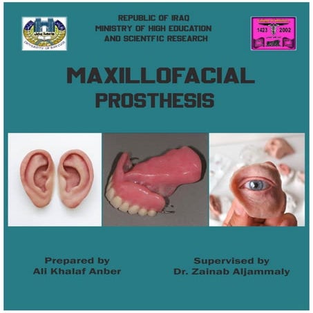 Maxillofacial Prosthesis