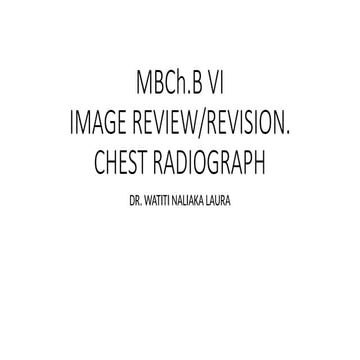 Mbchb VI  image review  CXR(4)forch.pptx