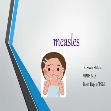 Measles