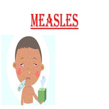 EPIDEMIOLOGY OF MEASELS | PPTX