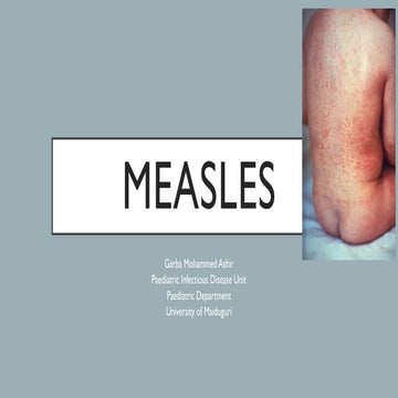 Measles | PPTX