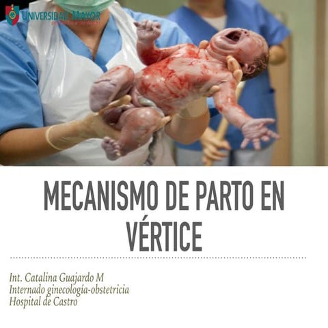 Mecanismo de Parto en Vértice 