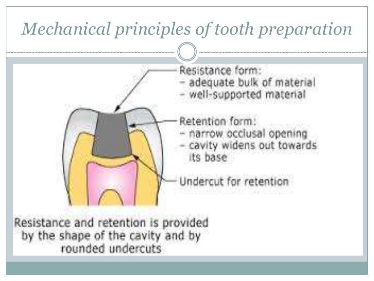 Dental Dental