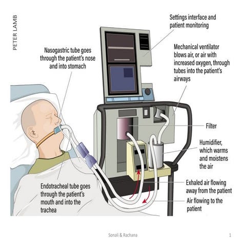 mechanicalventilation-200910122521 (1).pptx