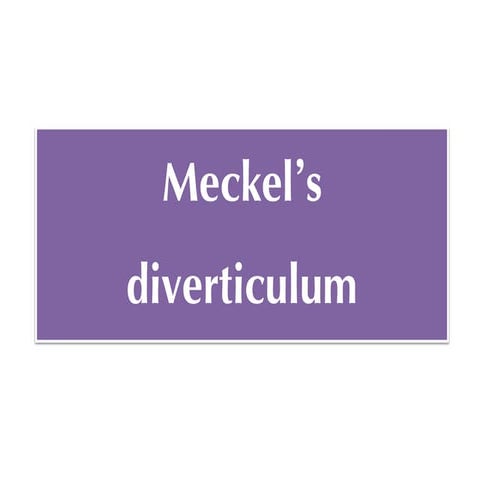 Meckel's diverticulum