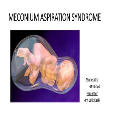 Meconium aspiration syndrome