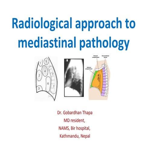 Mediastinal lesions   final