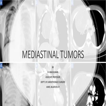 MEDIASTINAL TUMORS