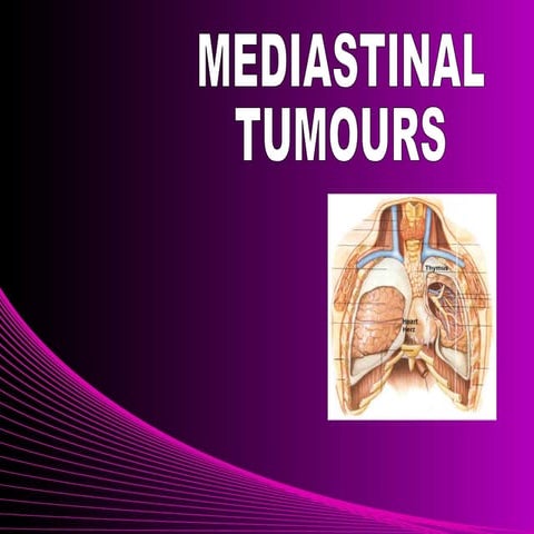 Mediastinal tumours