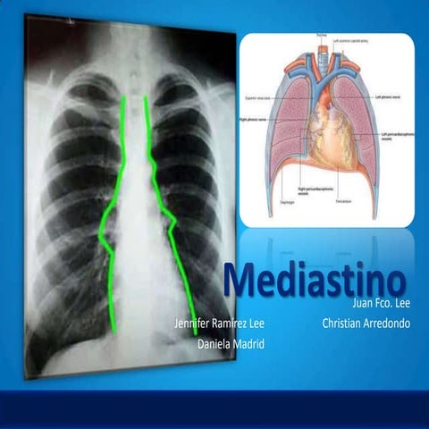 Mediastino