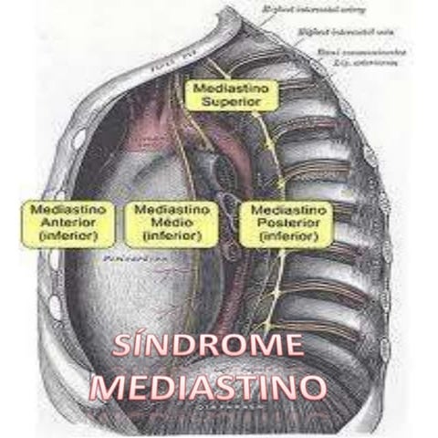 Mediastino 