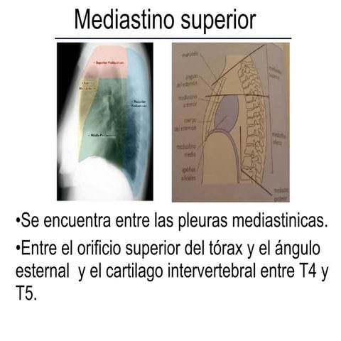 Mediastino superior