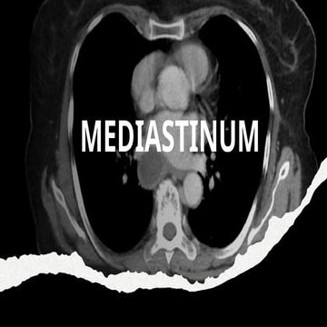 mediastinum and primary tumors of mediastinum