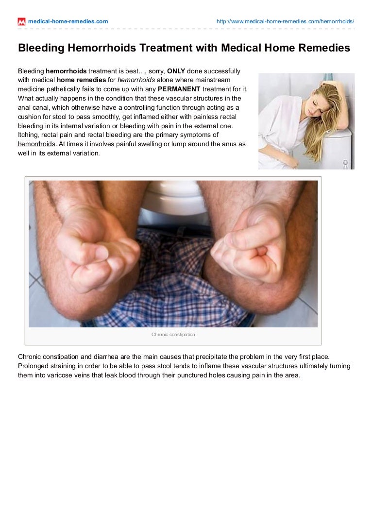 hemorrhoids home treatment