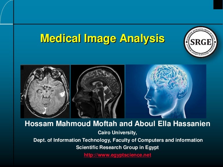 Medical image analysis
