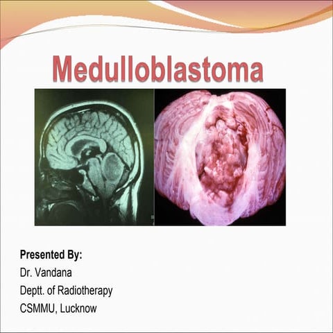 Diagnosis, Treatment & Management of Medulloblastoma 