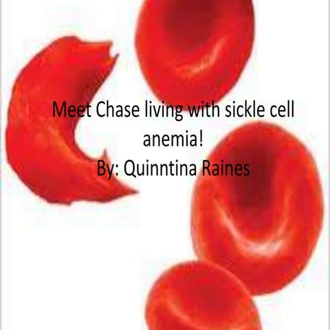 Meet chase living with sickle cell anemia!