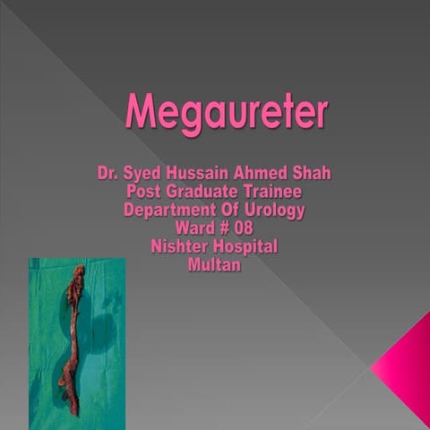 Megaureter ppt. Types, pathophysiology, evaluation and management.