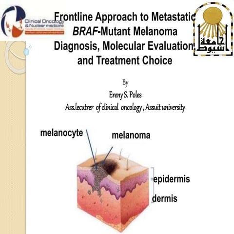 Melanoma frontline approach | PPTX