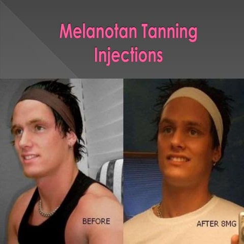 melanotan 2 before and after pictures Amazon.com : Vitamin C Lip Treatment main image 1