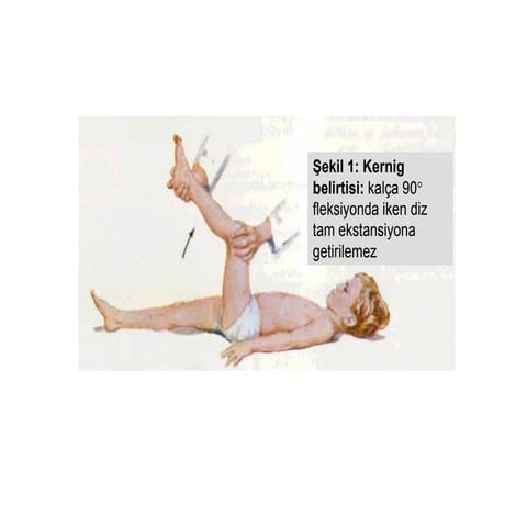 Menenjit (fazlası için www.tipfakultesi.org ) | PDF