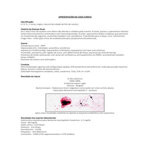 Questões Meningite Meningocócica 