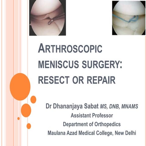 Arthroscopic Meniscus Surgery: Resect or Repair 2014