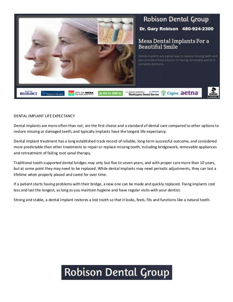Mesa Az Dentist Dental Implants Life Expectancy Dr Gary Robison