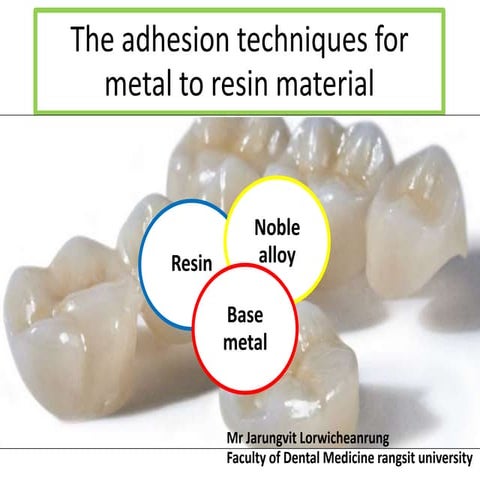 Metal primer ,silane,zirconia primer Reviews