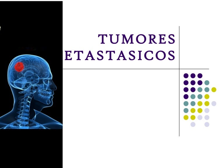 pronostico cancer de prostata con metastasis osea pronostico cancer de prostata con metastasis osea