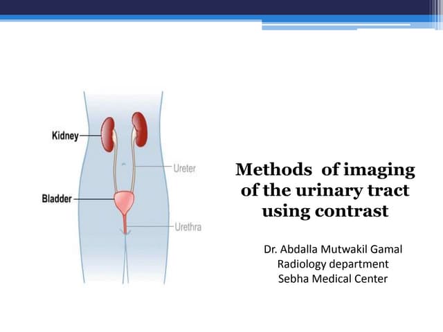 Radiological procedure of retrograde urethrography(rgu) and micturating ...