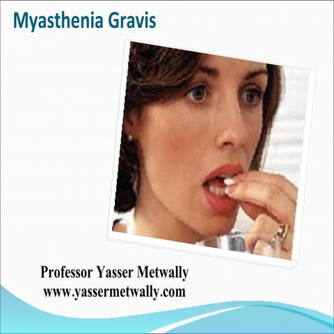 Lecture section...Myasthenia Gravis