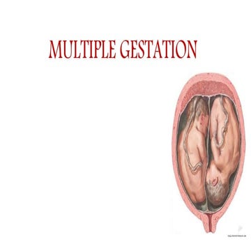 Multifetal pregnancy RADIOLOGY | PPTX