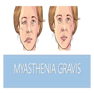 Myasthenia Gravis