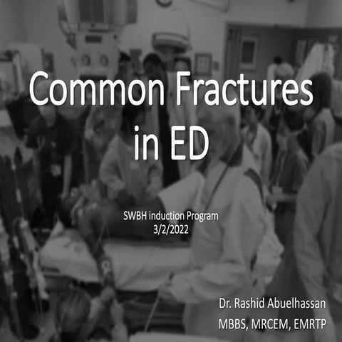 Management of common fractures in ED