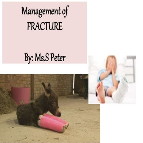 Management of Fractures 