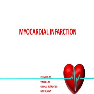 Myocardial Infarction
