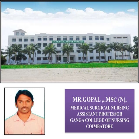 Myocardial infarction 