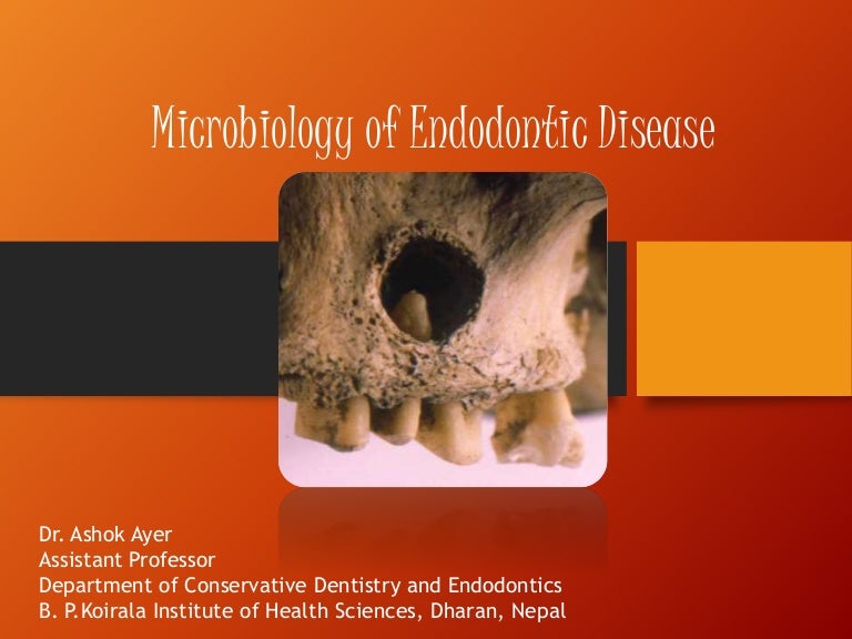 Microbiology of endodontic disease