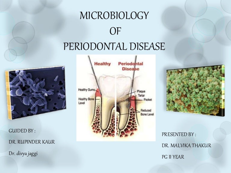 Microbiology of periodontal disease part 2