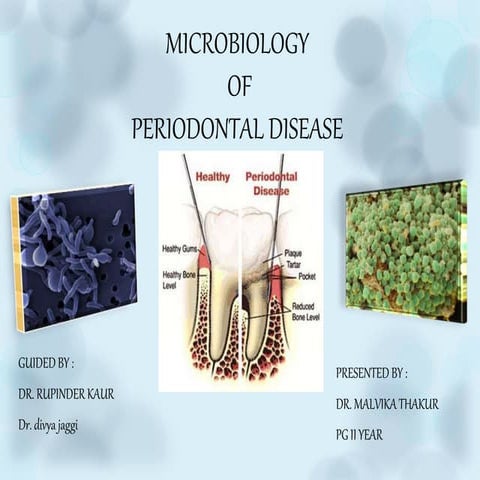 Microbiology of periodontal disease- part 2