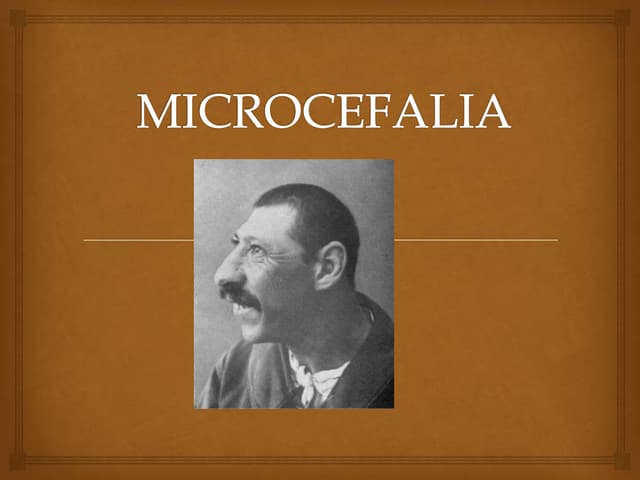 Microcefalia