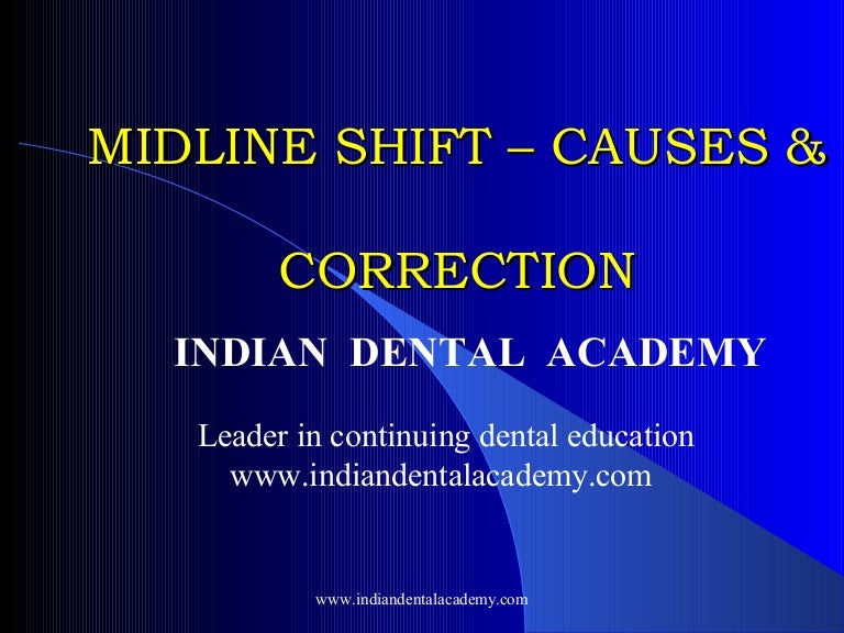 Midline shift /certified fixed orthodontic courses by Indian dental a…
