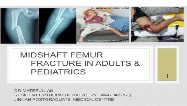 Inflatable Bone Tamp _ Kyphon Interventional Therapies – MRCQ