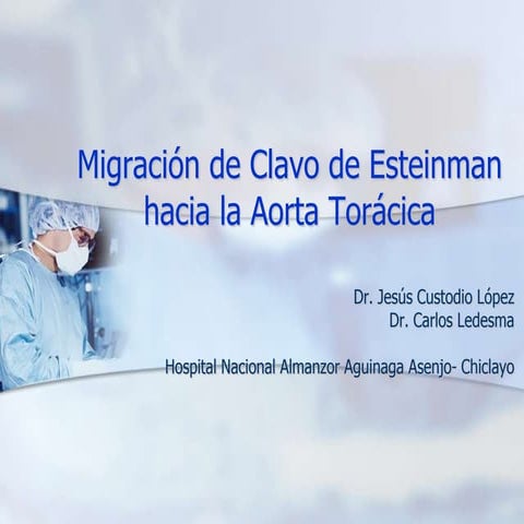Migración de clavo steinman
