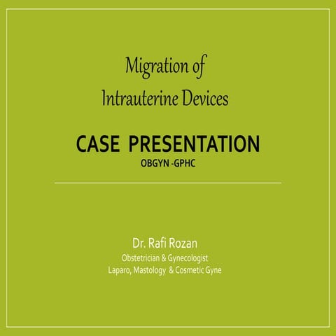 Migration of iud (dr.rafi rozan) | PPTX